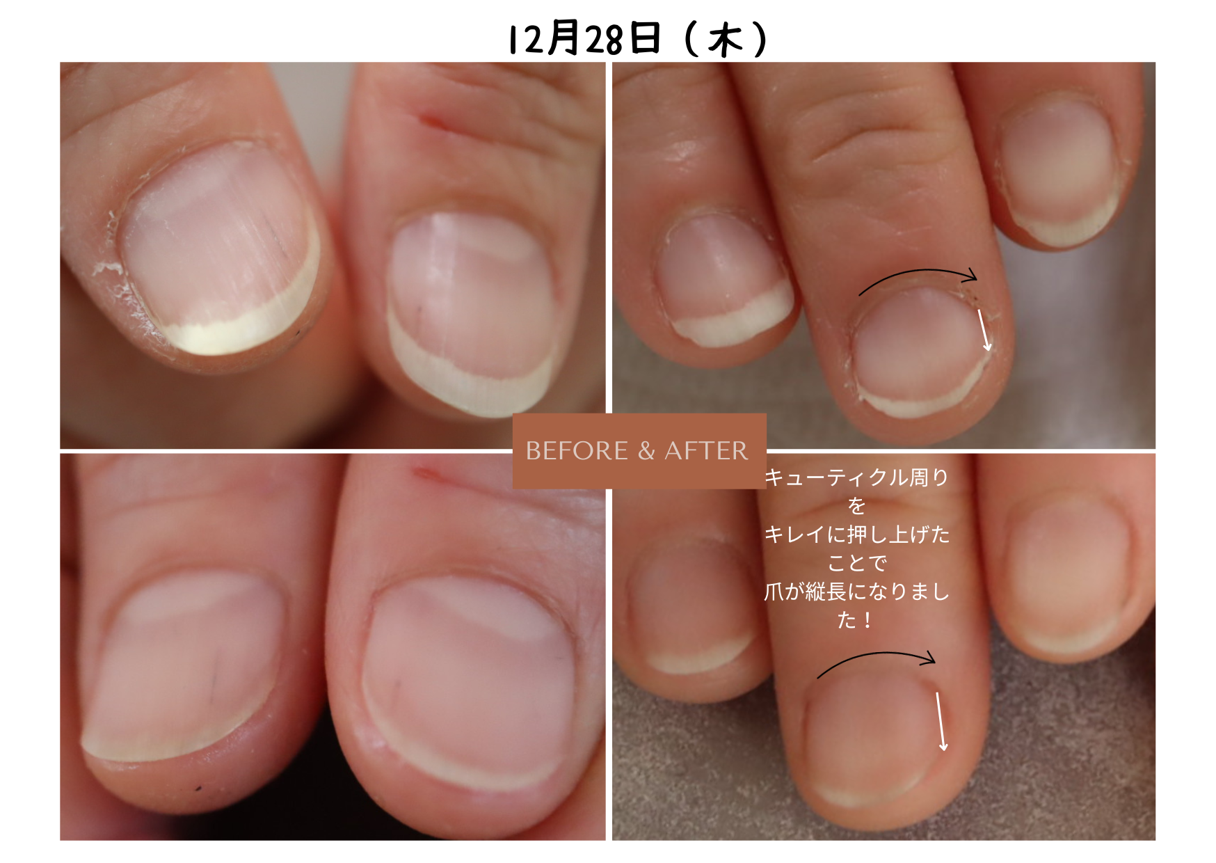 自爪育成の為のポイント